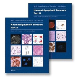 WHO Classification of Tumours Haematolymphoid Tumours (Volume 11) 5th edition