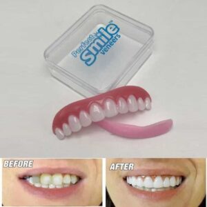 Perfect Smile Instant Smile Comfort Fit Flex Teeth Top Silikon kosmetisk faner