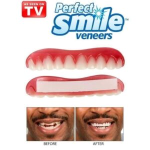 Kosmetiskt tandprotes - Smile Veneers - Tandkorrigering - Flexibel teknik - Rosa färg - Blandat